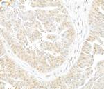 Lasu1/Ureb1 Polyclonal Antibody