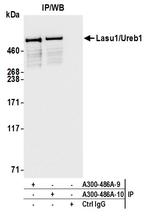 Lasu1/Ureb1 Antibody in Immunoprecipitation (IP)