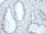 ASH2 Polyclonal Antibody