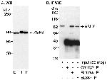 ASH2 Antibody in Western Blot (WB)
