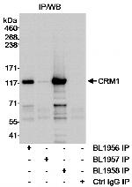 CRM1 Polyclonal Antibody
