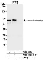 Estrogen Receptor Alpha Antibody in Immunoprecipitation (IP)