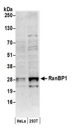 RanBP1 Polyclonal Antibody