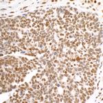 DDX1 Antibody in Immunohistochemistry (Paraffin) (IHC (P))