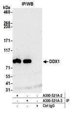 DDX1 Antibody in Immunoprecipitation (IP)