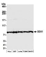 DDX1 Antibody in Western Blot (WB)