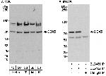 DDX5 Polyclonal Antibody