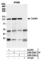 TAOK1 Antibody in Immunoprecipitation (IP)
