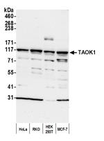 TAOK1 Polyclonal Antibody