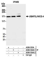 UBAP2L/NICE4 Antibody in Immunoprecipitation (IP)