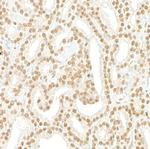 Pds5B Antibody in Immunohistochemistry (Paraffin) (IHC (P))
