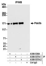 Pds5B Antibody in Immunoprecipitation (IP)