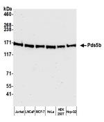 Pds5B Antibody in Western Blot (WB)