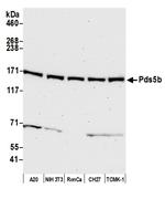 Pds5B Antibody in Western Blot (WB)
