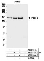 Pds5B Antibody in Immunoprecipitation (IP)