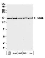 Pds5B Antibody in Western Blot (WB)
