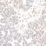 REST Polyclonal Antibody