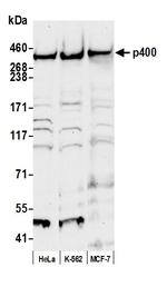 p400 Polyclonal Antibody