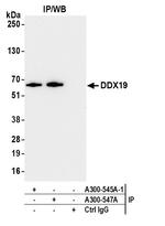DDX19 Antibody in Immunoprecipitation (IP)