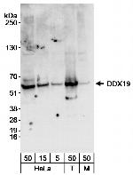 DDX19 Polyclonal Antibody
