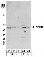 DDX19 Polyclonal Antibody