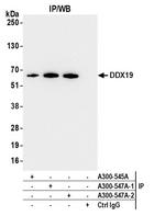 DDX19 Antibody in Immunoprecipitation (IP)