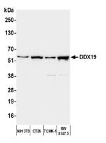 DDX19 Antibody in Western Blot (WB)