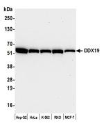 DDX19 Antibody in Western Blot (WB)