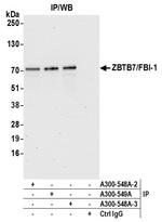 ZBTB7/FBI-1 Antibody in Immunoprecipitation (IP)