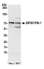 ZBTB7/FBI-1 Antibody in Western Blot (WB)