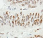 ZBTB7/FBI-1 Antibody in Immunohistochemistry (Paraffin) (IHC (P))