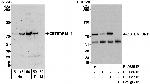 ZBTB7/FBI-1 Antibody in Western Blot (WB)