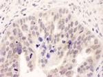 NMI Polyclonal Antibody