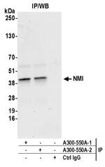 NMI Antibody in Immunoprecipitation (IP)