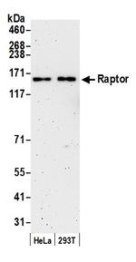 Raptor Polyclonal Antibody