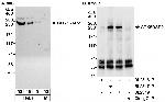 CDK5RAP2 Polyclonal Antibody