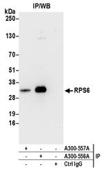 RPS6 Antibody in Immunoprecipitation (IP)
