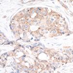 RPS6 Antibody in Immunohistochemistry (Paraffin) (IHC (P))