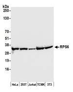 RPS6 Antibody in Western Blot (WB)