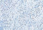 RIF1 Polyclonal Antibody