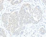 RIF1 Polyclonal Antibody