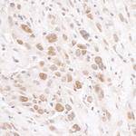 RIF1 Polyclonal Antibody
