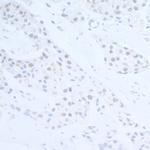 EDD1 Polyclonal Antibody