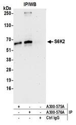 S6K2 Polyclonal Antibody