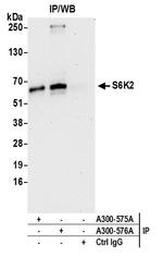S6K2 Antibody in Immunoprecipitation (IP)