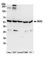 S6K2 Polyclonal Antibody