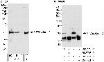 NF2 Polyclonal Antibody