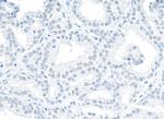 NONO Polyclonal Antibody
