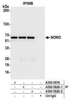 NONO Antibody in Immunoprecipitation (IP)