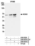 NONO Antibody in Immunoprecipitation (IP)